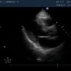 Dormed Hellas S3-1_5 Phased Array Cardiology