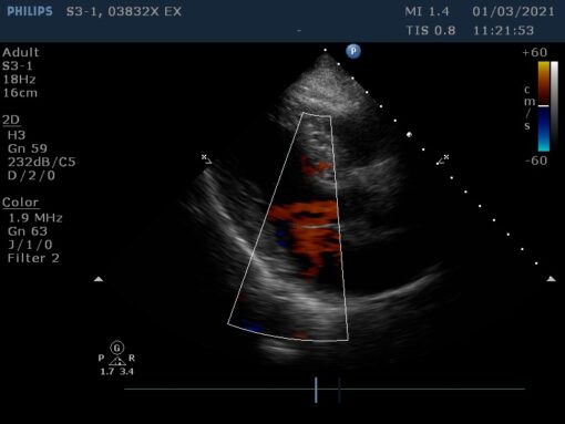 Dormed Hellas S3-1_6 Phased Array Cardiology
