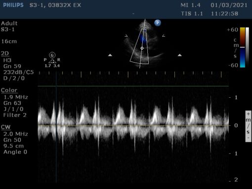 Dormed Hellas S3-1_8 Phased Array Cardiology