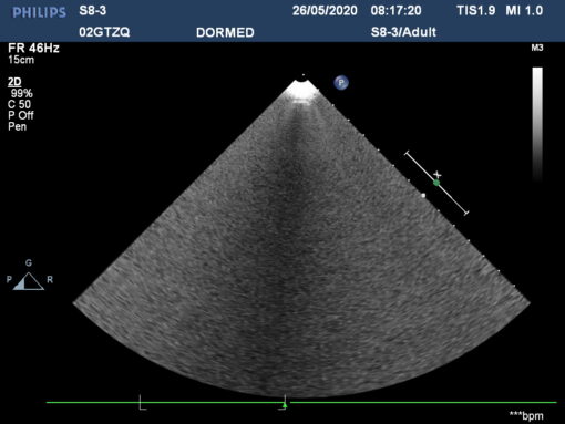 Dormed Hellas S8-3_4 Phased Array Cardiology