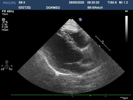 Dormed Hellas S8-3_5 Phased Array Cardiology