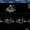 Dormed Hellas S8-3_8 Phased Array Cardiology