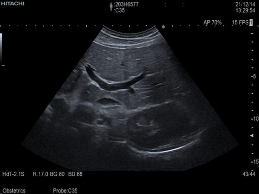 Dormed Hellas C35_5 Abdominal Convex