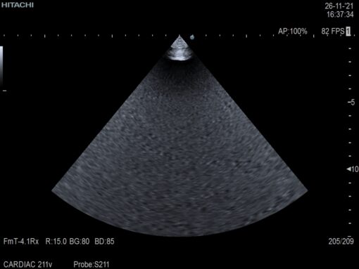 Dormed Hellas S211_4 Phased Array Cardiology