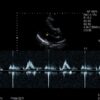 Dormed Hellas S211_7 Phased Array Cardiology