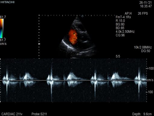 Dormed Hellas S211_8 Phased Array Cardiology