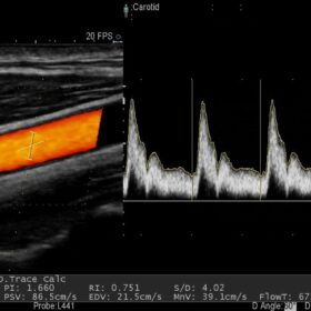 Dormed Hellas AR60 - Vascular doppler
