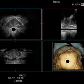 Dormed Hellas Noblus - Urology Radial 3D