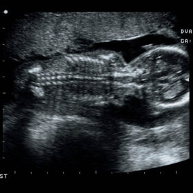Dormed Hellas Prosound 6 - Fetus