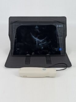 Dormed Hellas wifi_9 Phased Array Cardiology