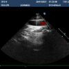 Dormed Hellas S12-4_6 Phased Array Cardiology