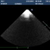 Dormed Hellas S5-1_4 Phased Array Cardiology