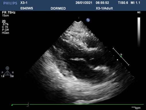 Dormed Hellas X3-1_5 xMatrix Cardiology