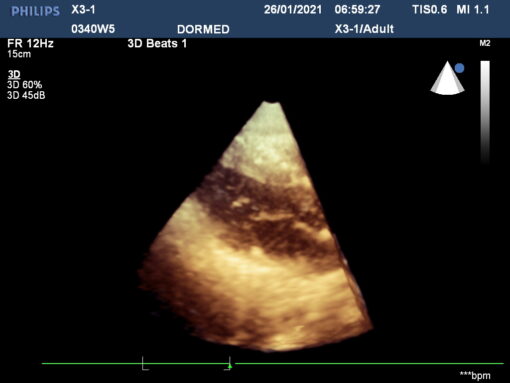 Dormed Hellas X3-1_7 xMatrix Cardiology