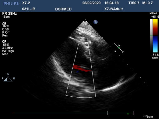 Dormed Hellas X7-2_6 Phased Array Cardiology