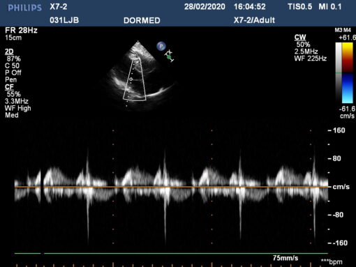 Dormed Hellas X7-2_8 Phased Array Cardiology
