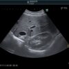 Dormed Hellas C252_5 Abdominal Convex