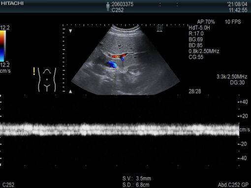 Dormed Hellas C252_7 Abdominal Convex