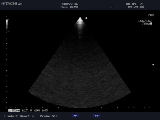 Dormed Hellas S11_5 Phased Array Cardiology