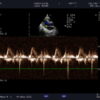 Dormed Hellas S11_8 Phased Array Cardiology