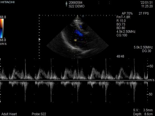 Dormed Hellas S22_7 Phased Array Cardiology