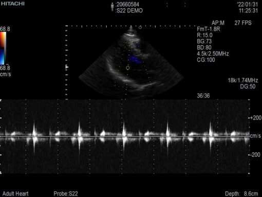 Dormed Hellas S22_8 Phased Array Cardiology
