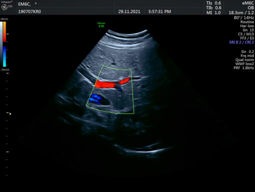 Dormed Hellas eM6C_7 Obstetrics Convex