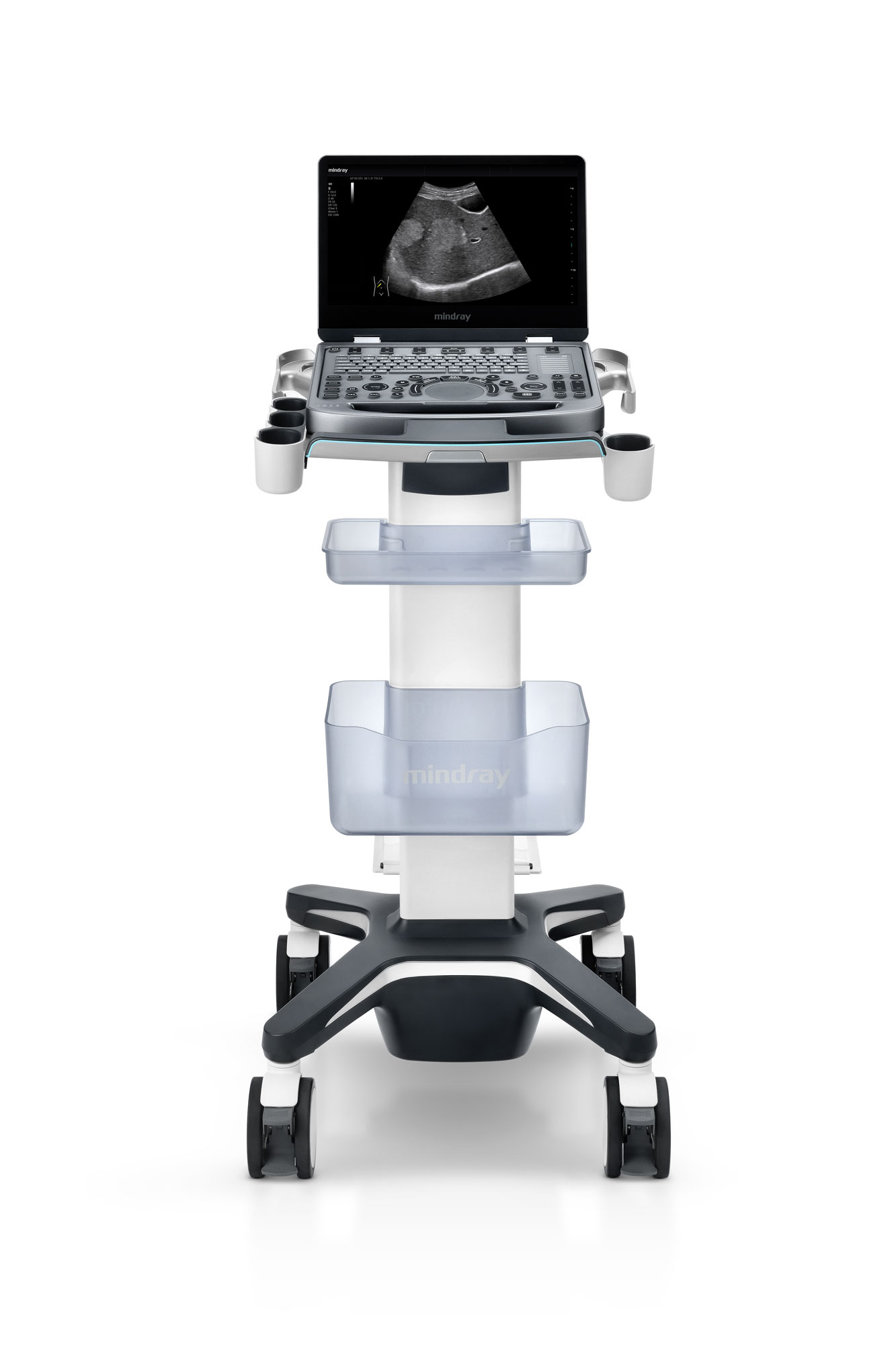 Mindray MX5 - Diagnostic Ultrasound System - Image 6