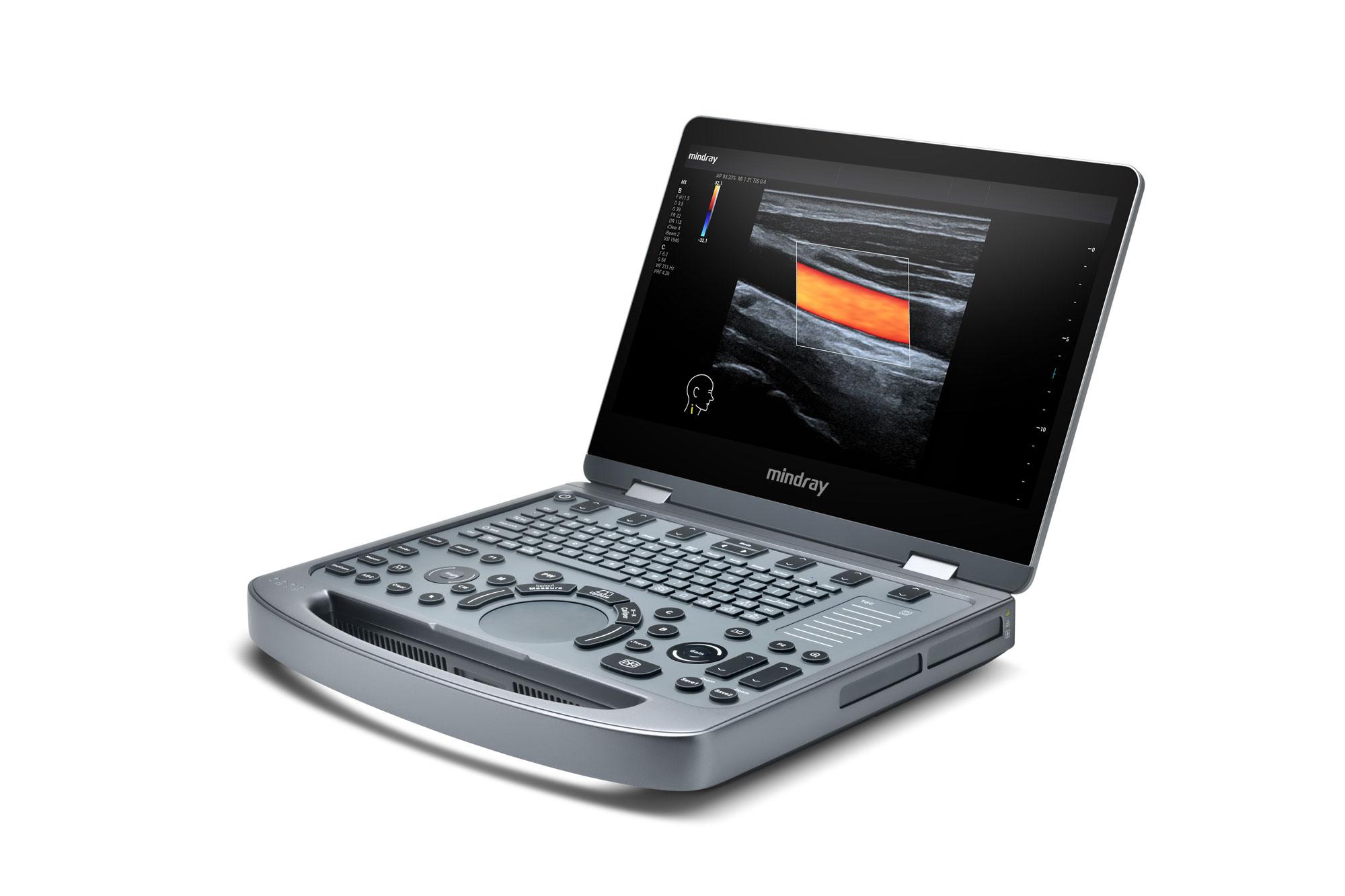 Mindray MX5 - Diagnostic Ultrasound System