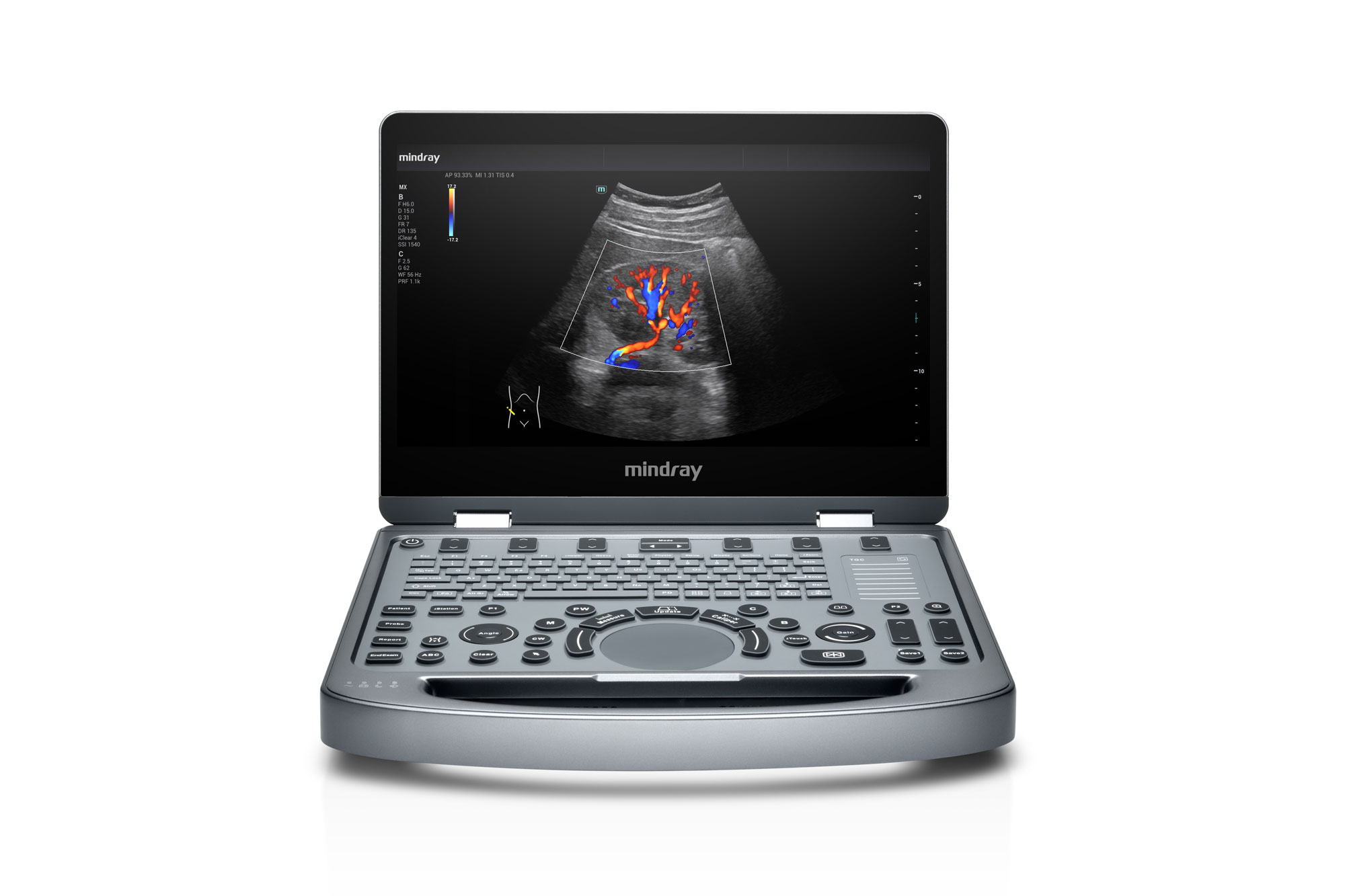 Mindray MX5 - Diagnostic Ultrasound System - Image 4