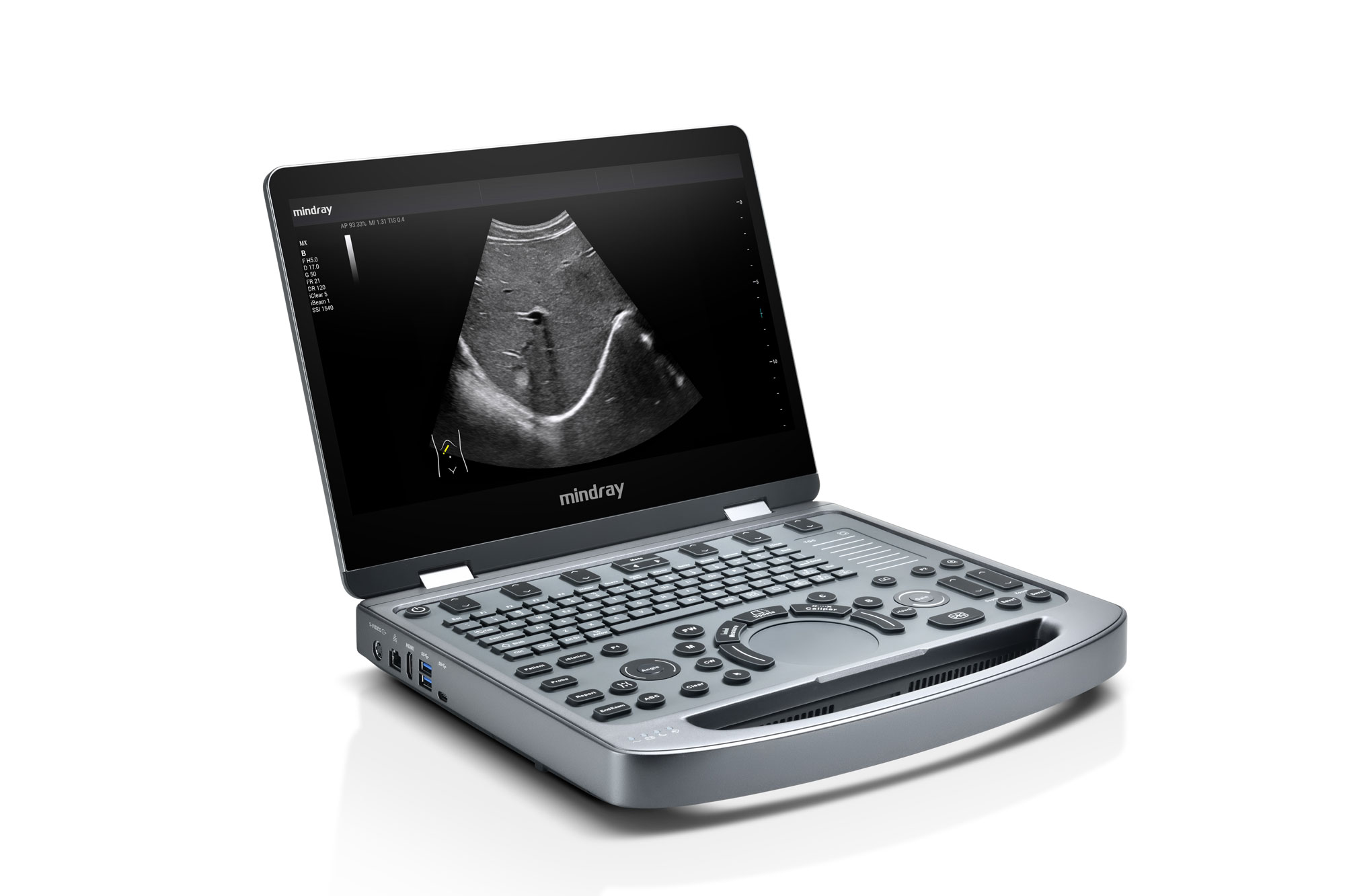 Mindray MX5 - Diagnostic Ultrasound System - Image 3