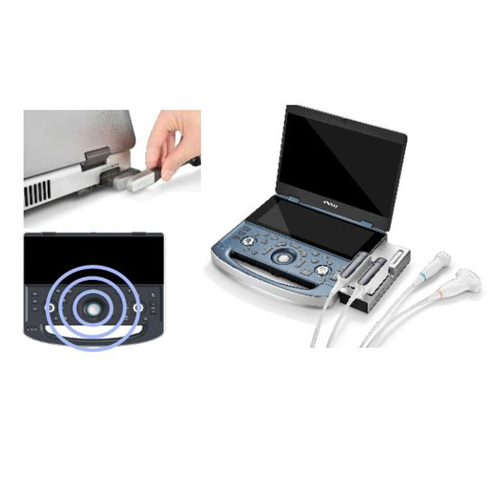 Mindray Zeus - Diagnostic Ultrasound System - Image 2