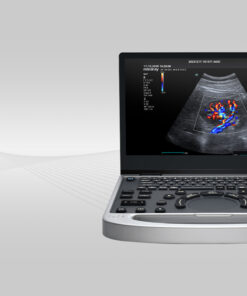 Mindray MU7 Diagnostic Ultrasound System