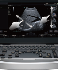 Mindray MU7 Device