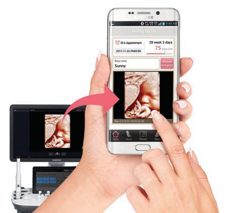 Samsung HS60 – Υπερηχογράφος - Image 4