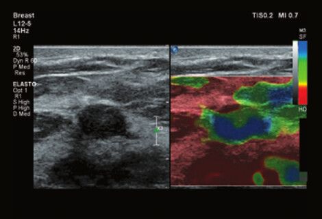 Philips Affiniti 70 – Diagnostic Ultrasound System - Image 2