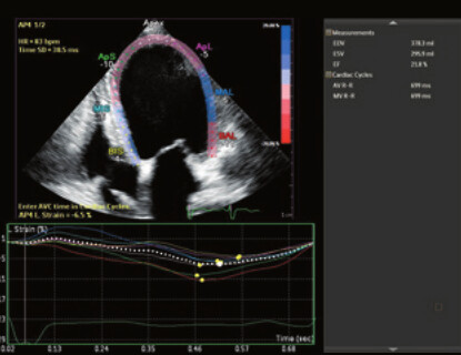 Philips Affiniti 70 – Diagnostic Ultrasound System - Image 3
