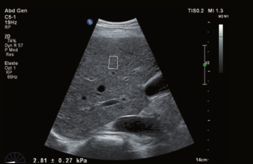 Philips Affiniti 70 – Diagnostic Ultrasound System - Image 4