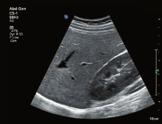 Philips Affiniti 70 – Diagnostic Ultrasound System - Image 5