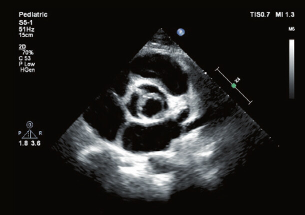 Philips Affiniti 70 – Diagnostic Ultrasound System - Image 6
