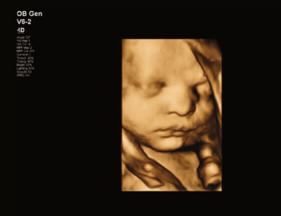 Philips Affiniti 70 – Diagnostic Ultrasound System - Image 7