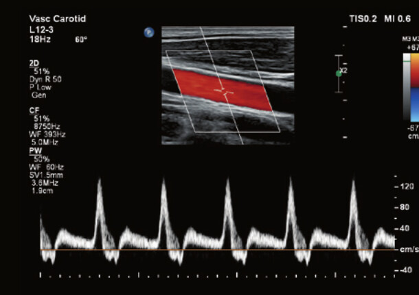Philips Affiniti 70 – Diagnostic Ultrasound System - Image 8