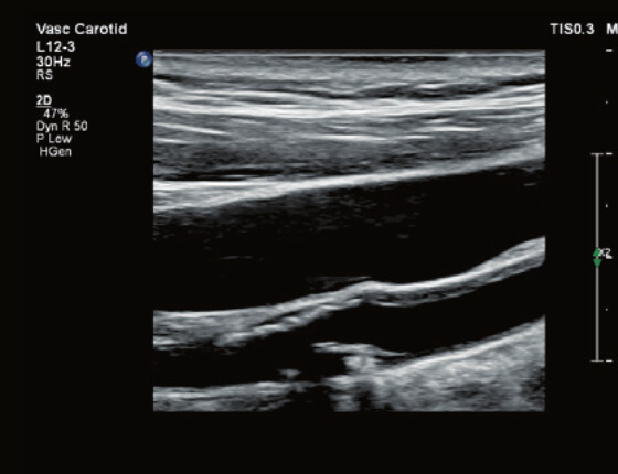 Philips Affiniti 70 – Diagnostic Ultrasound System - Image 9