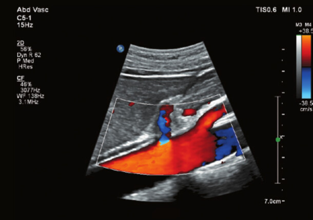 Philips Affiniti 70 – Diagnostic Ultrasound System - Image 10