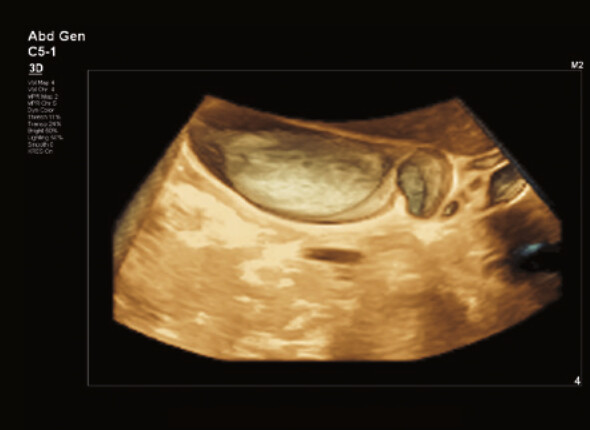 Philips Affiniti 70 – Diagnostic Ultrasound System - Image 11