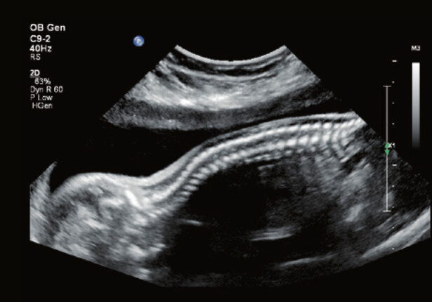 Philips Affiniti 70 – Diagnostic Ultrasound System - Image 12