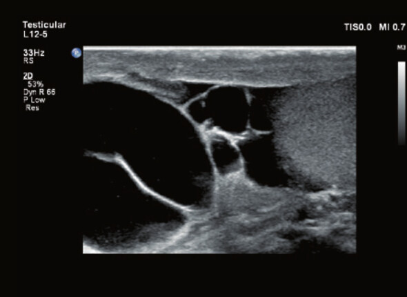 Philips Affiniti 70 – Diagnostic Ultrasound System - Image 13