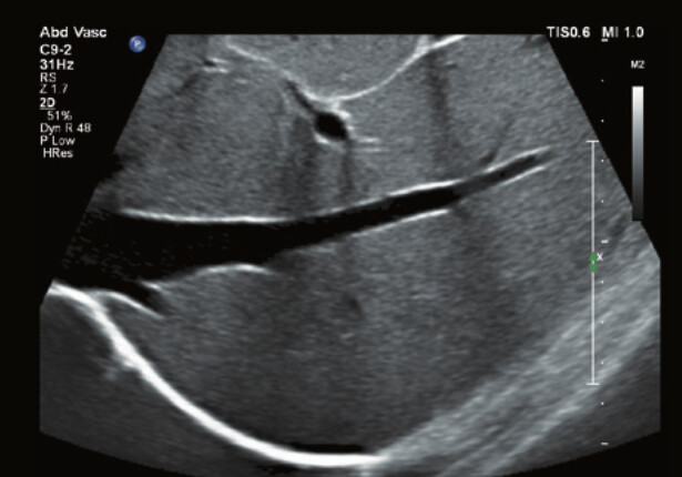 Philips Affiniti 70 – Diagnostic Ultrasound System - Image 14