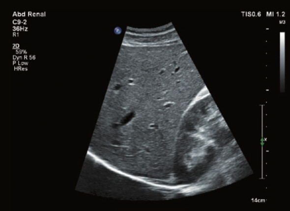 Philips Affiniti 70 – Diagnostic Ultrasound System - Image 15