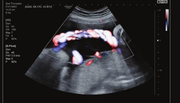 Samsung HS60 – Diagnostic Ultrasound System - Image 6
